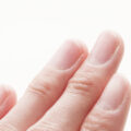 【ネイリスト直伝】爪周りの皮膚がボロボロの方へ！ケア方法とアイテムをご紹介