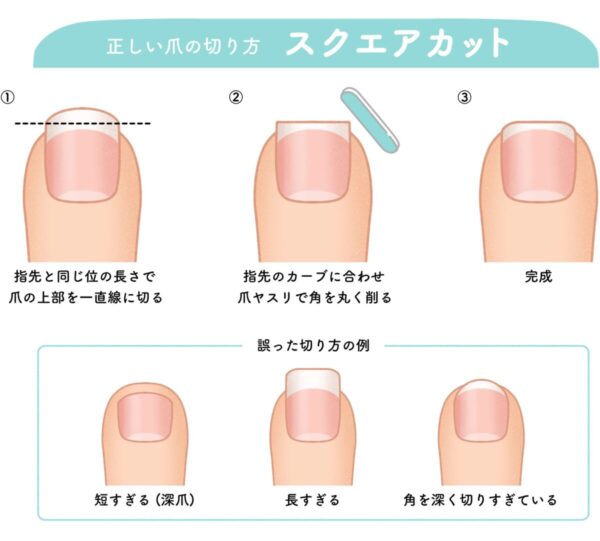 【ネイリスト解説】足の小指の爪が小さいのは治る？ケアとネイルの楽しみ方